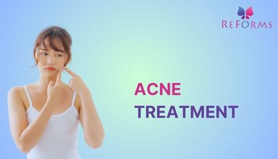 Acne Treatment