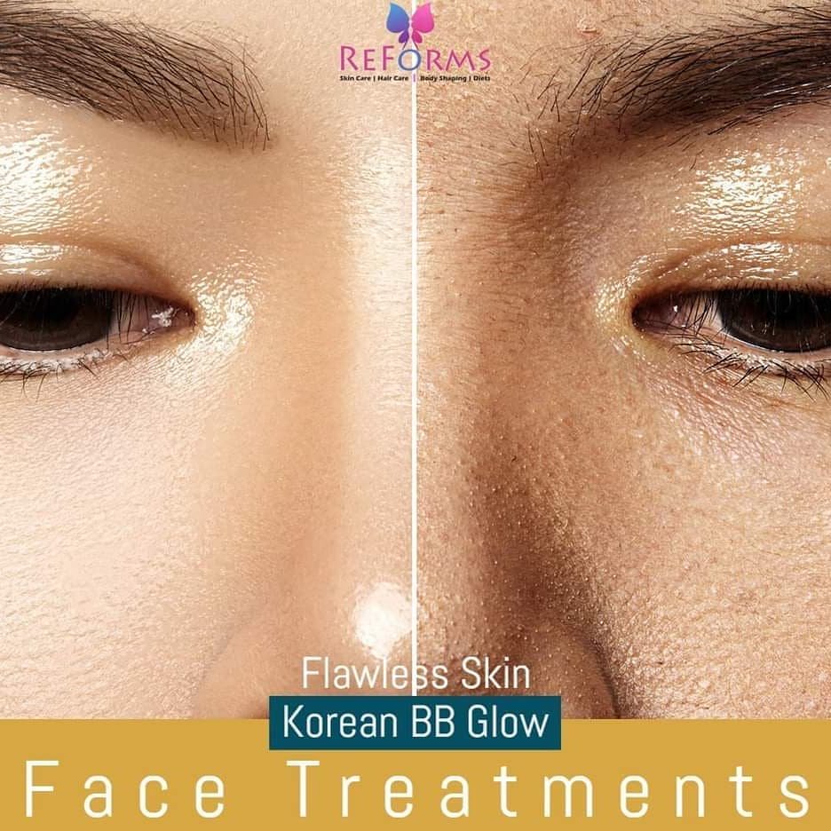 Skin Brightening Treatment, Medifacial Procedure at Our Clinic, Laser-like Spectra Carbon Peel Treatment, Anti-Clock Facial Signature Treatment, Hydradermabrasion Non-Invasive Procedure, Microdermabrasion for Skin Texture Improvement, Glutathione Skin Whitening Process, Hydroquinone Treatment: Risks and Benefits